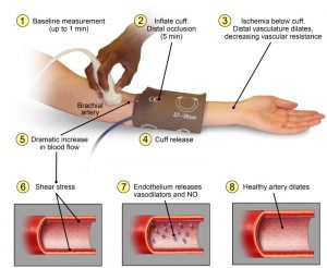 FMD - Description of flow mediate dilation technique for in vivo assessment of conduit artery endothelium-mediated vasodilation