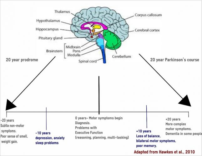 Parkinson's when you sleep better, you feel better Research Impact
